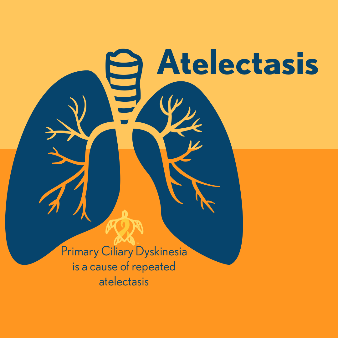 Atelectasis, a common clinical consequence of Primary Ciliary Dyskinesia