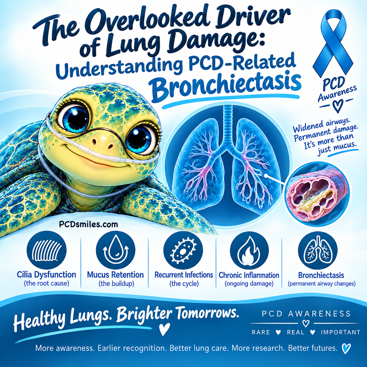 The Overlooked Driver of Lung Damage: Understanding PCD-Related Bronchiectasis